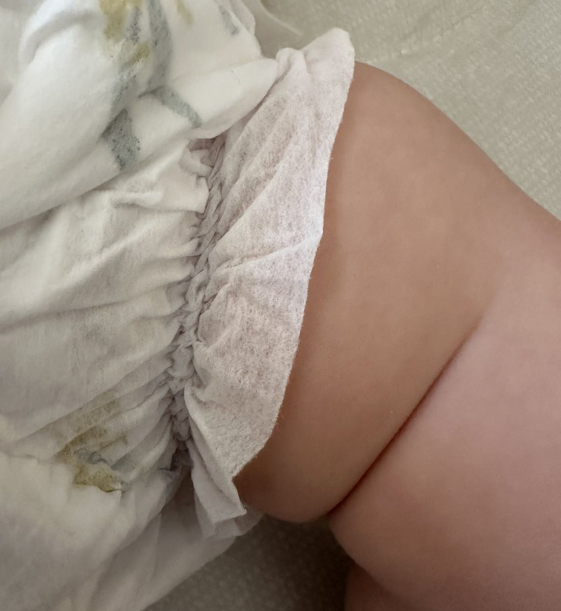The same cuff on a baby, standing out around the thigh and sitting down in the crease rather than folded back under itself